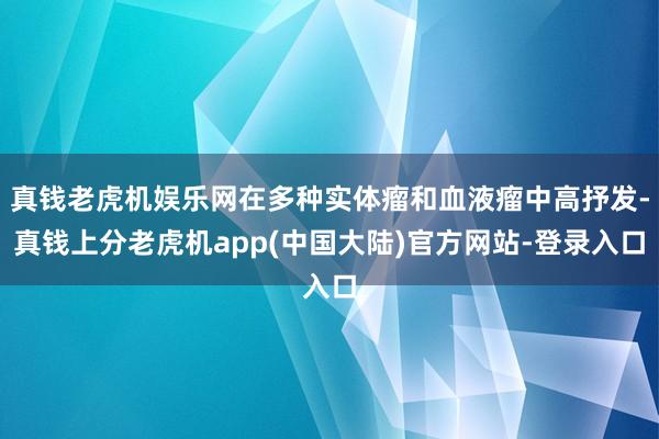 真钱老虎机娱乐网在多种实体瘤和血液瘤中高抒发-真钱上分老虎机app(中国大陆)官方网站-登录入口